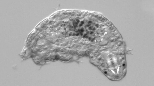 Image of a tardigrade taken at microscopic level. 